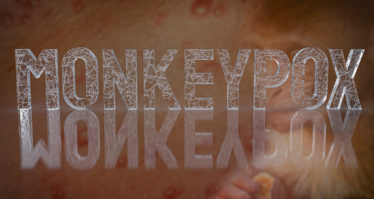 What is Monkeypox