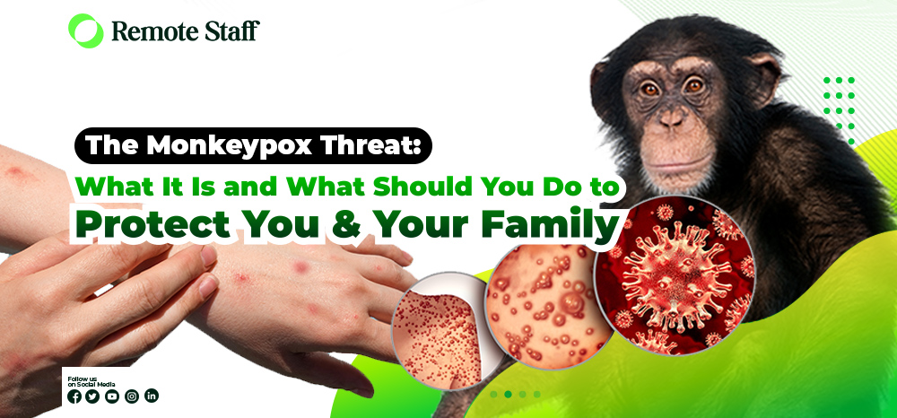 The Monkeypox Threat What It Is and What You Should Do to Protect You and Your Family